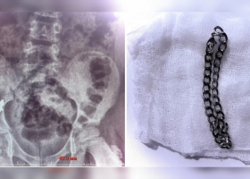 Фото: Министерство здравоохранения Воронежской области цкпо