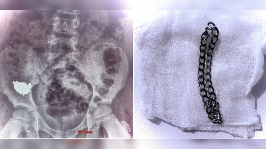 цкпо Фото: Министерство здравоохранения Воронежской области