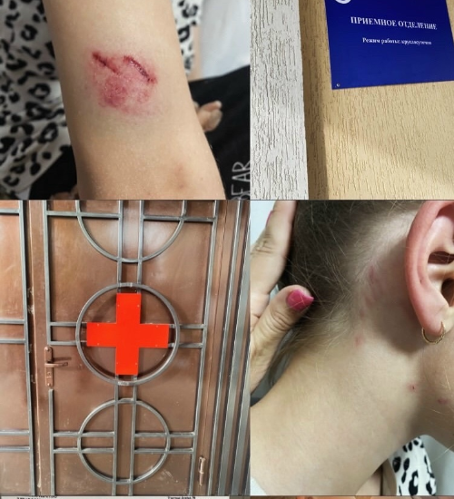 ФОТО НЕТИПИЧНАЯ КАНТЕМИРОВКА