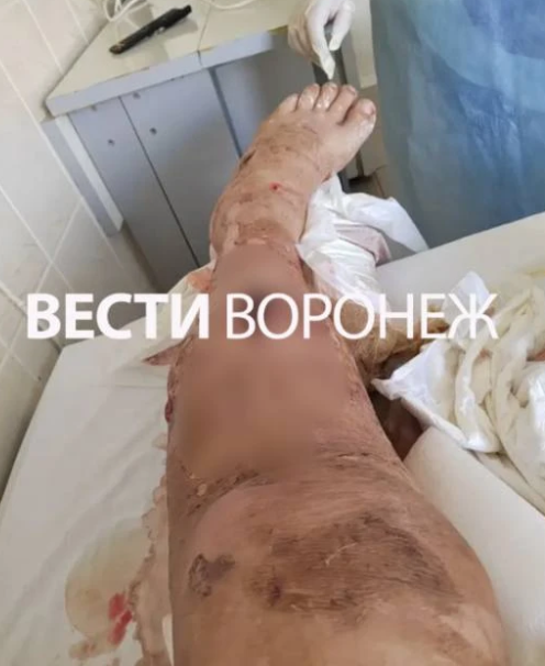 фот о Вести Воронеж